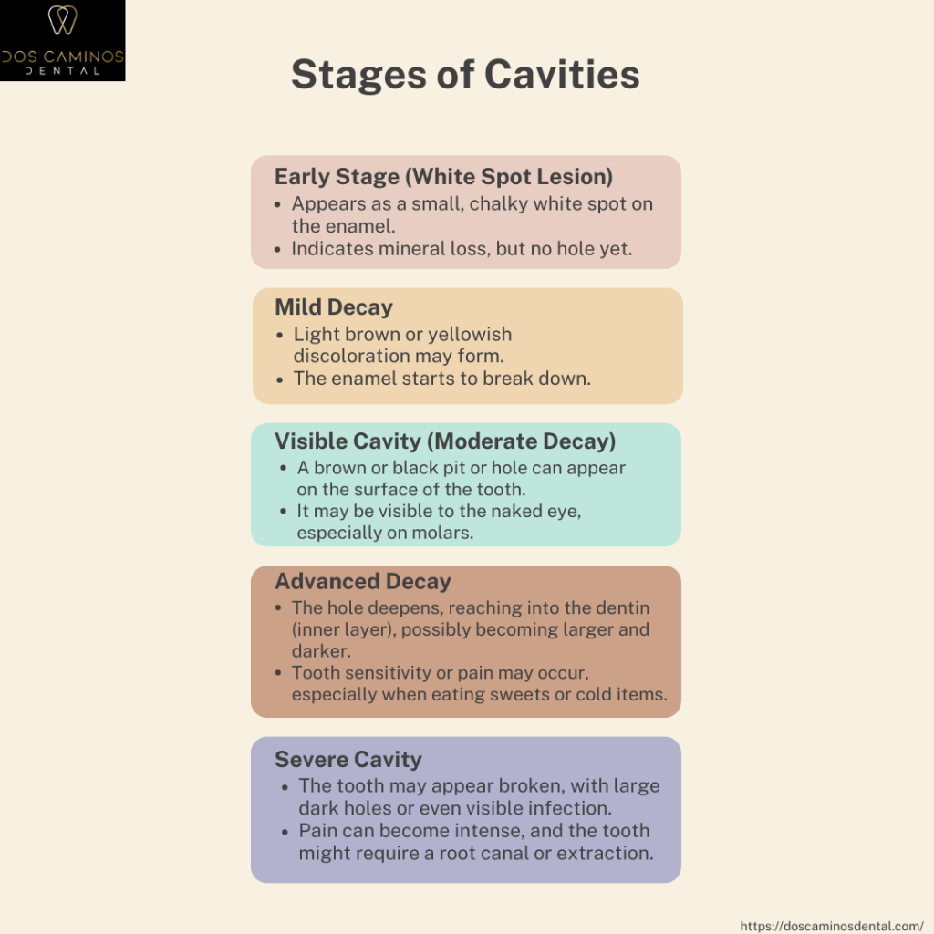 Stages of Cavities