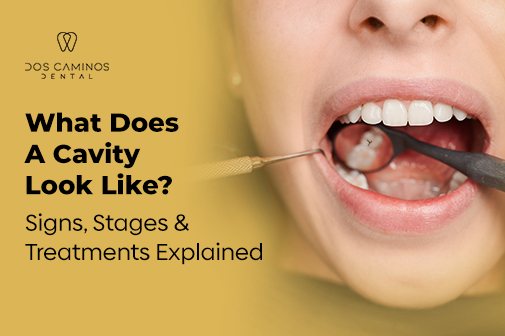 What Does A Cavity Look Like